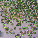 Phytoplankton under the microscope